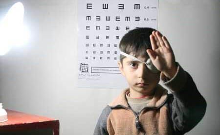 شناسایی ۳۶۰۰ کودک مبتلا به اختلالات و تنبلی چشم