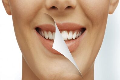 تبعات تبلیغات ترمیم دندان های هنرپیشه ها و ورزشکاران