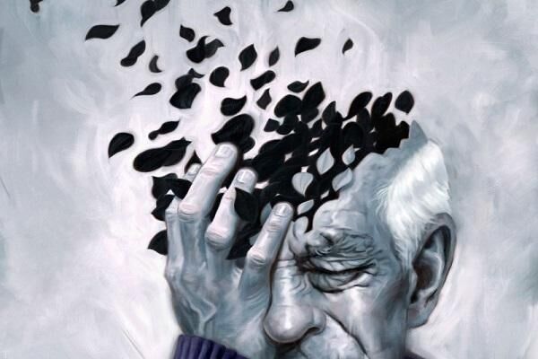 آلزایمر شایع ترین بیماری زوال عقل