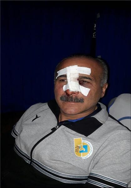 فوتبال در ایران، یک ورزش خطرناک!