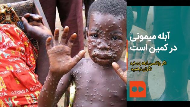 آبله میمون به مراکش هم رسید