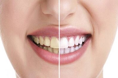 در روز چند بار مسواک بزنیم؟
