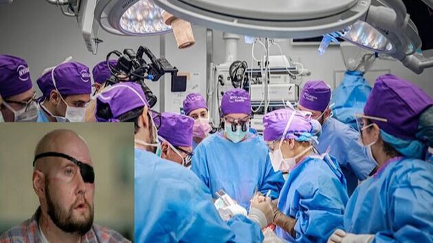 کلاهبرداری با آگهی فروش قرنیه