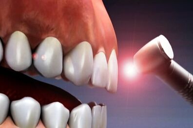 مسواک نزدن با مرگ ومیر در ارتباط است