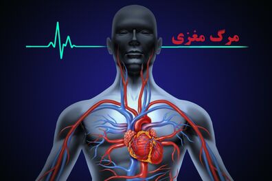سالانه حدود 5 هزار مرگ مغزی در کشور رخ می دهد