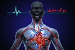 سالانه حدود 5 هزار مرگ مغزی در کشور رخ می دهد