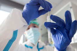 آخرین آمار مبتلایان به کرونا در جهان اعلام شد